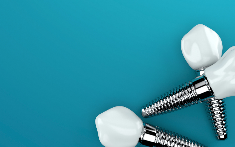 implantes-dentais-individuais