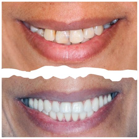 Susana MArtins Antes e Depois